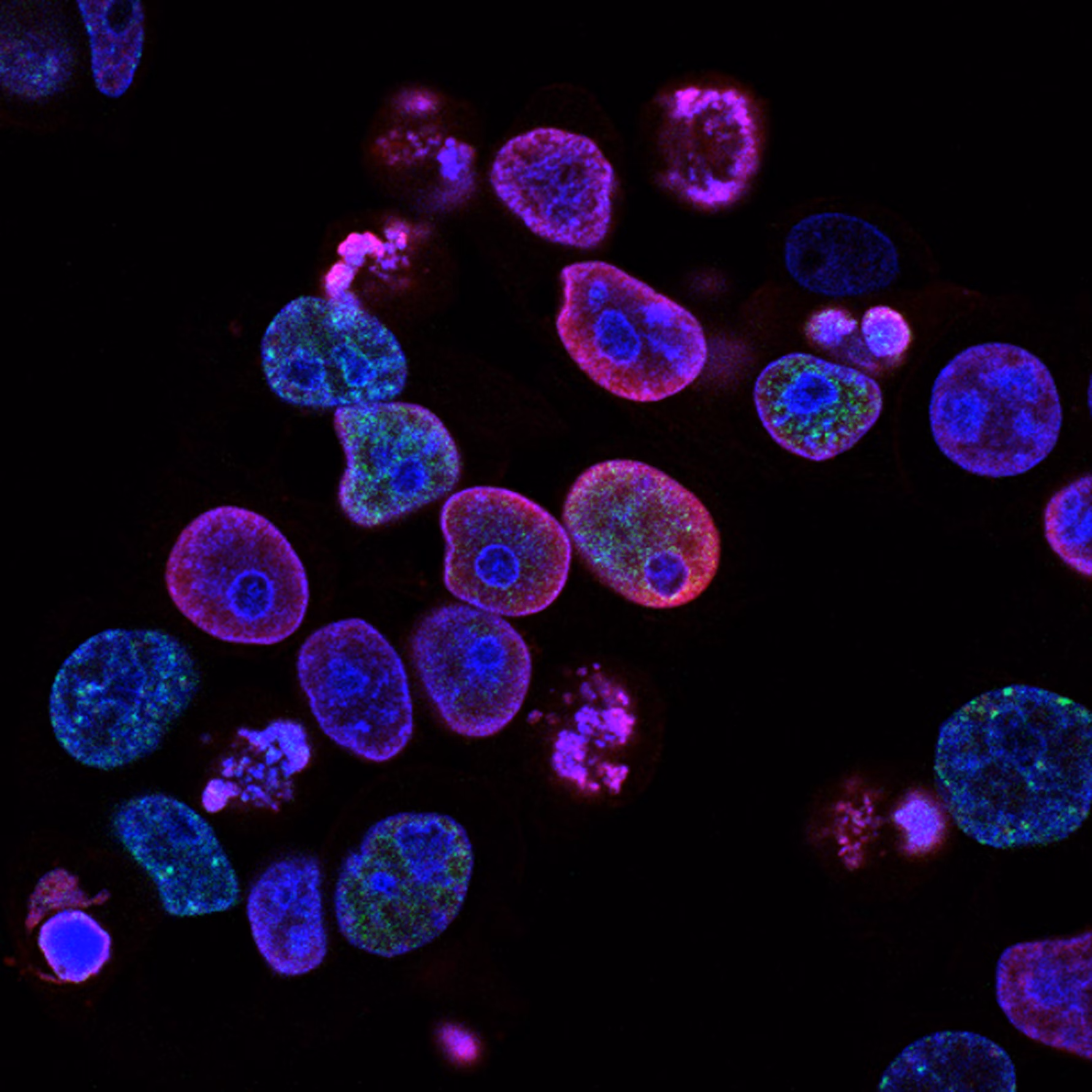 Microscopy image of glowing cells